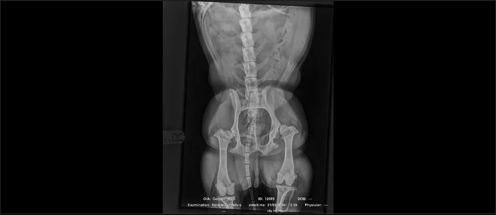 Mylo hip X-ray before surgery