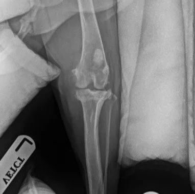 Pepper X-ray before surgery